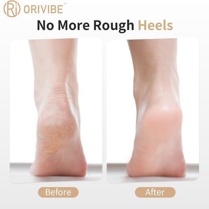 Electric Foot Callus Remover for Feet - Rechargeable Pedicure Tools, 2-Speed Electric Foot File with Washable Rollers, Instant Dead Skin Remover & Foot Care Gift for Women and Men