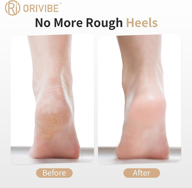 Electric Foot Callus Remover for Feet - Rechargeable Pedicure Tools, 2-Speed Electric Foot File with Washable Rollers, Instant Dead Skin Remover & Foot Care Gift for Women and Men